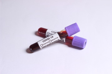 Close Up Photo, Simple Conceptual Hand Draw Sketch Vector, Glass Blood Covid-19 Test tube, without result