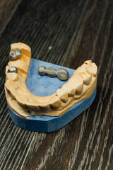 dentistry and process details