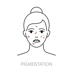 Skin pigmentation disorders vector icon line style