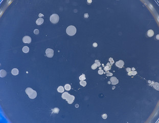 Tests for skin fungal diseases. Samples of fungus causing skin diseases grown in a petri dish