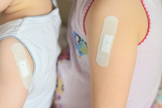 Children with patch on forearm after tuberculosis vaccine