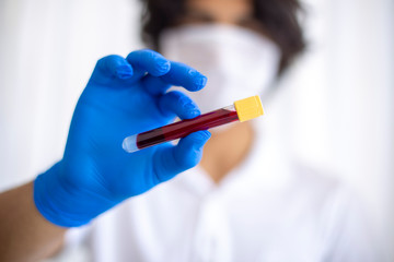 A gloved junior doctor holding  blood test result for plasma in Turkey
