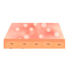 Papules. Acne on the skin. Dermatological and cosmetic diseases on the skin of the face acne. Infographics. Vector illustration on isolated background.