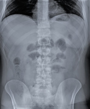 x-ray of the abdominal and pelvic organs