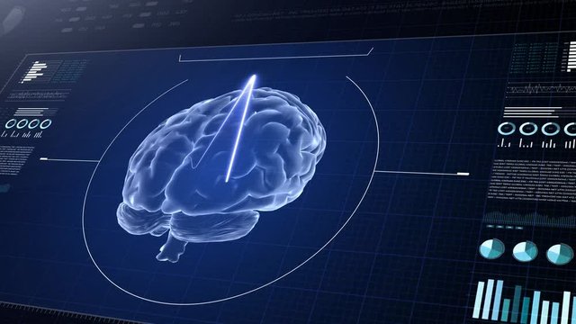Human brian study on diagnostic computer display.