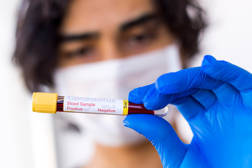 A gloved junior doctor holding a positive blood test result for coronavirus in Turkey