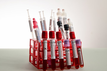 Various test tubes, pipettes and coronavirus tests. Microbiology concept