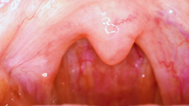 CU, macro view, slow motioin: medical examination of sore throat and top of oral cavity lit with flashlight extreme closeup