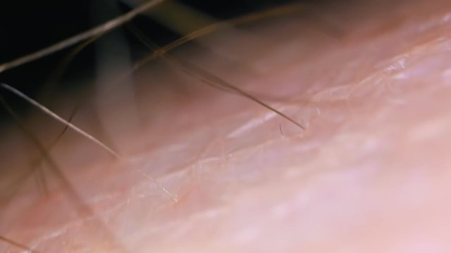 CU, macro view: slow motioin above human bare leg skin with growing brown hair on dark background extreme closeup