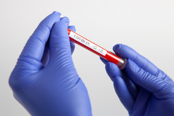 Obraz premium Coronavirus blood test concept. Doctor's hand in a medical glove holding a test tube with positive coronavirus blood over a laboratory desk. Coronavirus COVID-19. Pandemic.