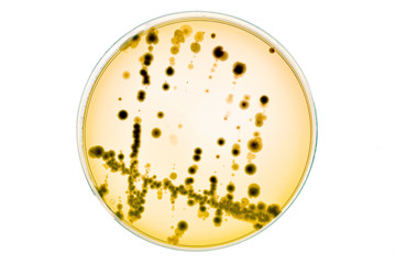 Growing Bacteria in Petri Dishes on agar gel Scientific experiment.
