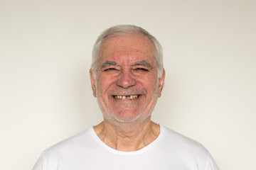 old man senior face closeup missing tooth smile proper dental care insurance health