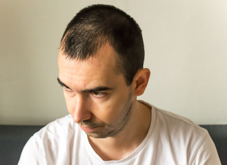 Fototapeta premium hair loss symptoms and causes, man model sit black hair young closeup hair loss sad