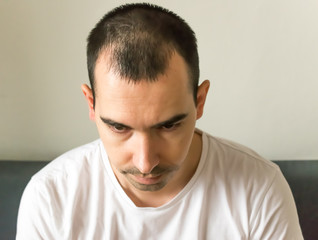 hair loss symptoms and causes, man model sit black hair young closeup hair loss sad