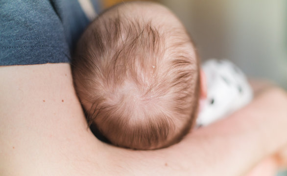 A father holiding a Newborn , close up on a head (scalp) with cradle cap (infantile seborrheic dermatitis)