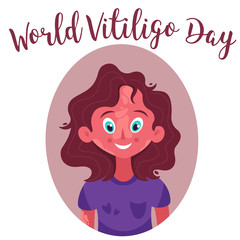 World vitiligo day. Beautiful girl with vitiligo, natural beauty. Vector illustration in flat style.