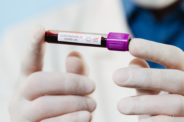 A virologist doctor is examining a sample of a blood test with suspected Covid-19 virus.