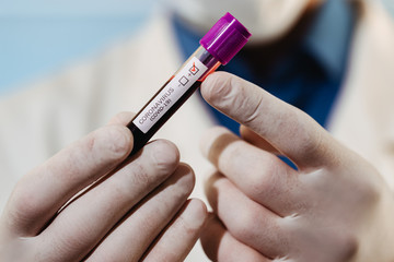 A virologist doctor is examining a sample of a blood test with suspected Covid-19 virus.
