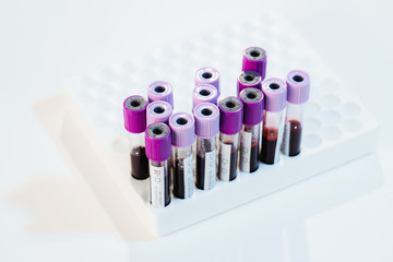 Closed flasks with positive and negative blood tests for Covid-19 in the laboratory
