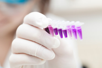 PCR Strip test tube in the laboratory