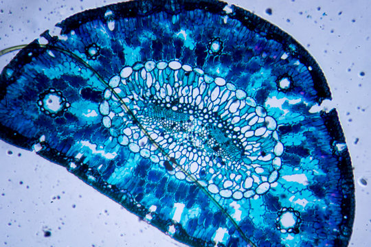 Microscopic image of pine leaf cross-section