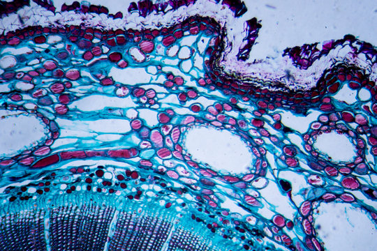 Microscopic image of Pine Stem (cross-section)