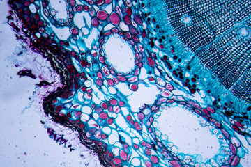 Microscopic image of Pine Stem (cross-section)