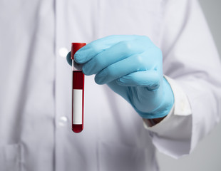 Hand of a doctor holding test tube with blood plasma ready for testing