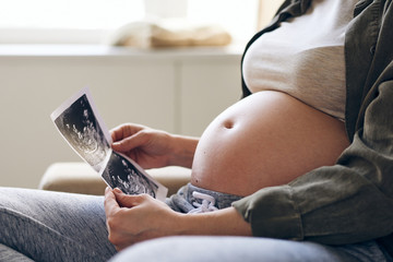Close-up of unrecognizable pregnant woman looking at fetal ultrasound image while thinking of baby in her womb