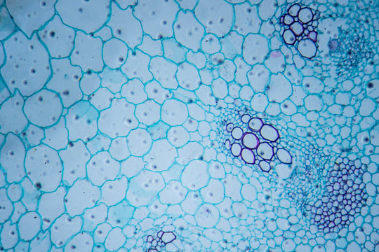 Microscopic image of sunflower stem (cross-section)