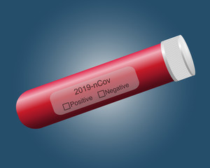 Coronavirus analysis. Test tube with a label. Coronavirus Covid-19