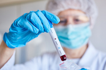 Test for Covid-19 coronavirus positive in blood sample