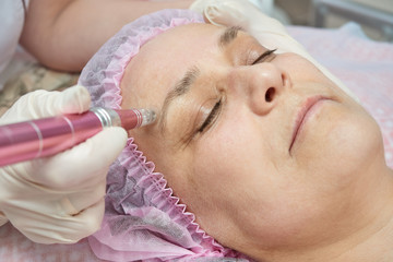 Obraz na płótnie Canvas A mature beautiful woman lies with her eyes closed during a mesotherapy procedure.