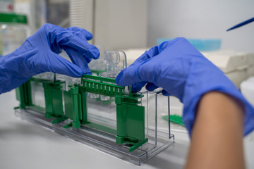 The general process preparation for protein levels detection is using western blot analysis. This method is involved in Protein separation by gel electrophoresis.