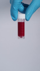 Blood tests in clear tube on doctor hands with blue medical gloves and PPE suit which represent coronavirus or 2019-ncov or covid-19 pandemic screening test that positive results or infected 