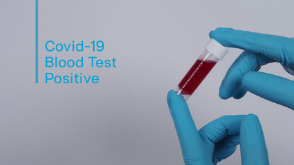 Blood tests in clear tube on doctor hands with blue medical gloves and PPE suit which represent coronavirus or 2019-ncov or covid-19 pandemic screening test that positive results or infected 