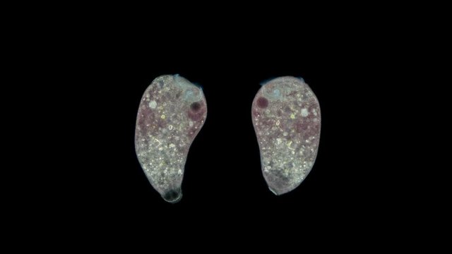 Infusoria Stentor under the microscope, the family Stentoridae, class Ciliata, feed on small organic residues, bacteria, algae, protozoa.