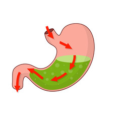 Stomach and rout of pill. Dissolving drug. Disease of human internal organ. Cartoon flat illustration. Taking medicine. Medical care. Pain in belly. Red arrow. Oral preparation application