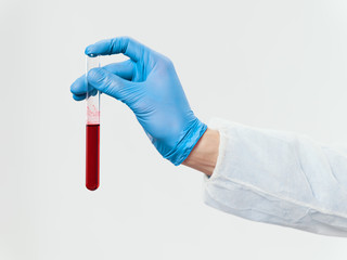 Blood tests for laboratory infection infection study