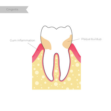 Vector isolated illustration of tooth 