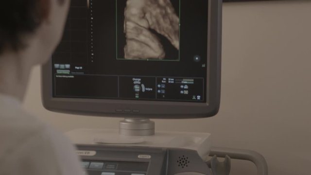ultrasound doctor examines a pregnant girl, belly of a pregnant girl