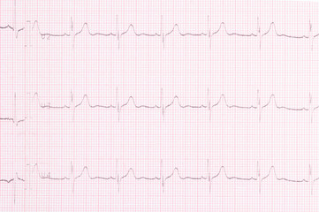 cardiogram result of the study of the heart top view, background closeup
