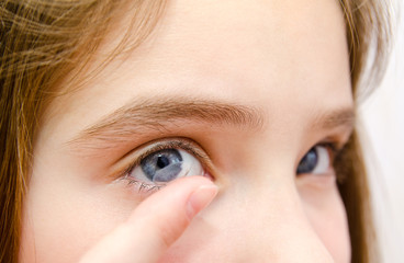 Little girl child putting contact lens into her eye closeup