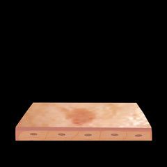 Pigmentation on the skin. Brown spots on the skin. Pigmentation treatment. Infographics. Vector