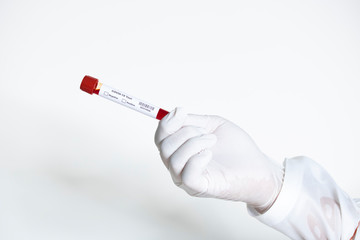 blood test covid19 infection lab result contagious disease outbreak of novel coronavirus