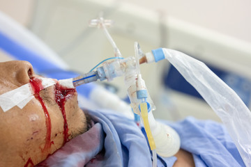 Crisis patients with bleeding in the mouth and nasal cavity can not help themselves. Respirator is necessary at all times.