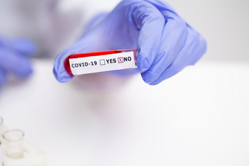 Obraz premium Doctor holds test tube with covid-19 test.