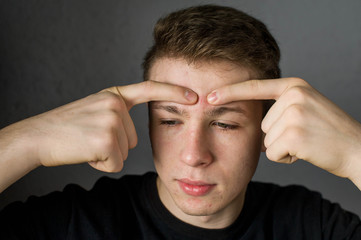 Young man struggling with acne on his face caring for his skin pushes acne presses a pimple on the forehead and contorts the face