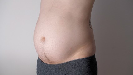 Fat male stomach. Weight loss or weight gain during quarantine. Attractive man with bare belly. Close-up of male beer belly of sexy man. Bodypositive