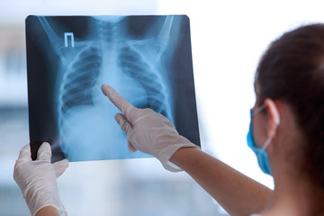 Doctor examines an X-ray